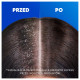 Head & Shoulders Apple Fresh Codzienny Szampon Przeciwłupieżowy 400 ml. Każde Włosy